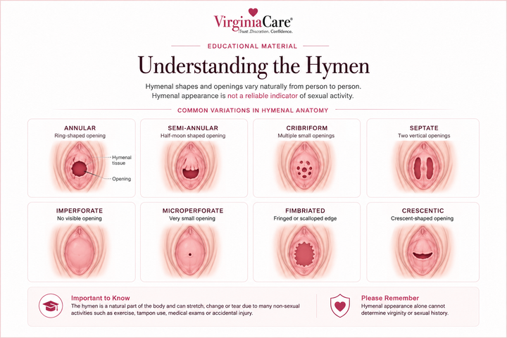 Educational medical illustration showing common hymen anatomy variations and natural hymenal shapes